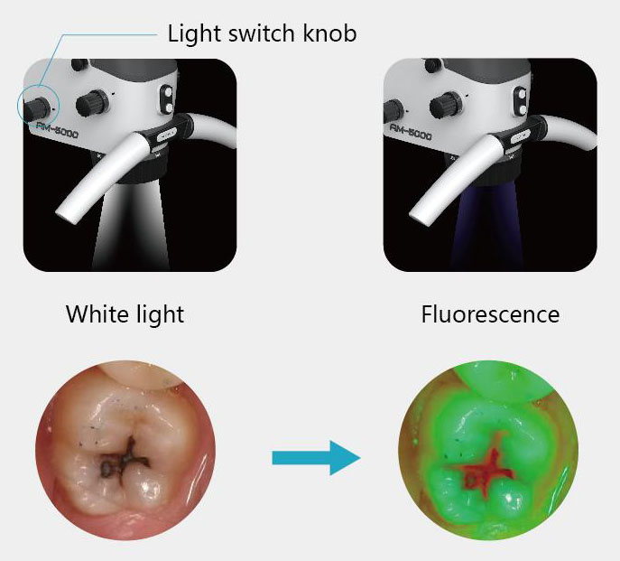 Fluorescence and White Illumination